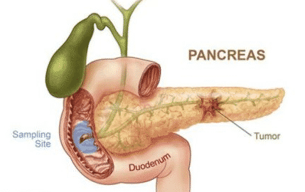 struktur pankreas