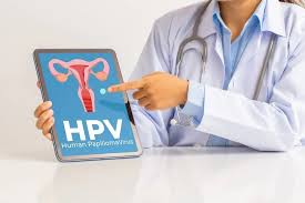 Gejala HPV yang Sering Tidak Disadari, Kenali Tanda dan Risikonya Sejak Awal